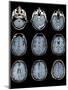 Normal Brain, MRI Scans-ZEPHYR-Mounted Premium Photographic Print
