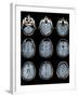 Normal Brain, MRI Scans-ZEPHYR-Framed Premium Photographic Print