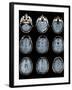 Normal Brain, MRI Scans-ZEPHYR-Framed Premium Photographic Print