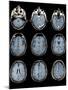 Normal Brain, MRI Scans-ZEPHYR-Mounted Premium Photographic Print