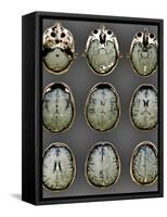 Normal Brain, MRI Scans-ZEPHYR-Framed Stretched Canvas