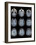 Normal Brain, MRI Scans-ZEPHYR-Framed Photographic Print