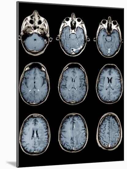 Normal Brain, MRI Scans-ZEPHYR-Mounted Photographic Print