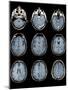 Normal Brain, MRI Scans-ZEPHYR-Mounted Photographic Print
