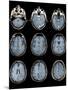 Normal Brain, MRI Scans-ZEPHYR-Mounted Photographic Print