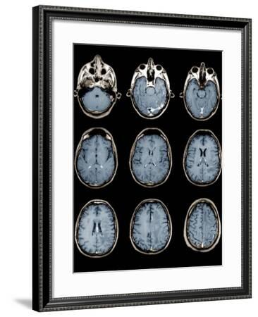 brain mri scan master mri axial