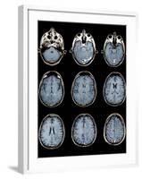 Normal Brain, MRI Scans-ZEPHYR-Framed Photographic Print