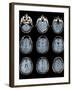 Normal Brain, MRI Scans-ZEPHYR-Framed Photographic Print