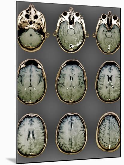 Normal Brain, MRI Scans-ZEPHYR-Mounted Photographic Print