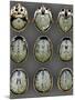 Normal Brain, MRI Scans-ZEPHYR-Mounted Photographic Print