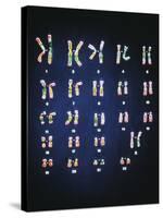 Normal Female Chromosomes-null-Stretched Canvas