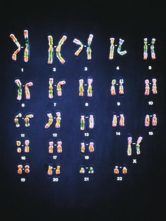 'Normal Female Chromosomes' Photographic Print | AllPosters.com