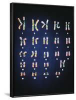 Normal Female Chromosomes-null-Framed Photographic Print