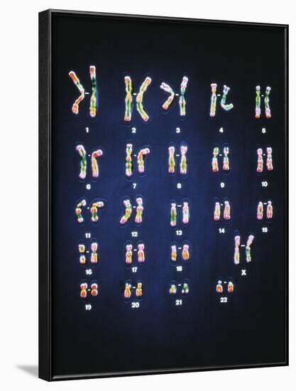 Normal Female Chromosomes-null-Framed Photographic Print