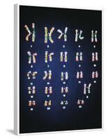 Normal Female Chromosomes-null-Framed Photographic Print
