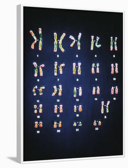 Normal Female Chromosomes-null-Framed Photographic Print