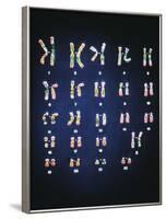 Normal Female Chromosomes-null-Framed Photographic Print