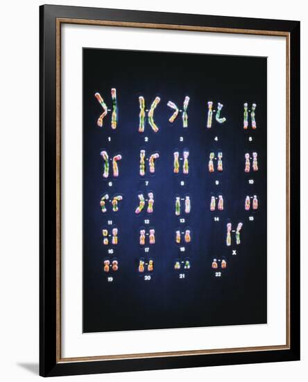 Normal Female Chromosomes-null-Framed Photographic Print