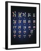 Normal Female Chromosomes-null-Framed Photographic Print