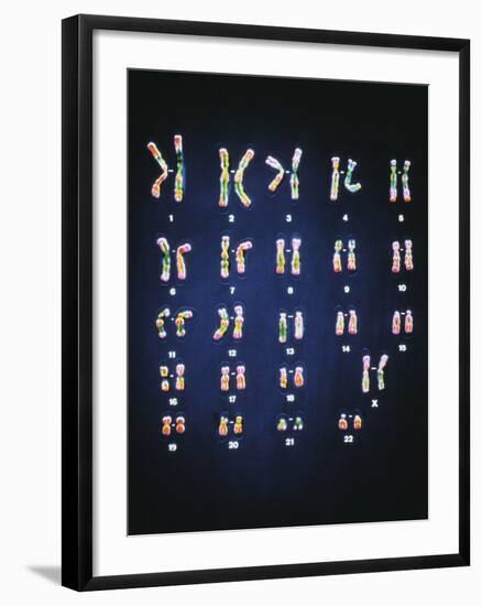 Normal Female Chromosomes-null-Framed Photographic Print