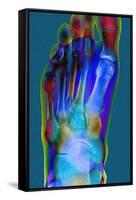 Normal Foot, X-ray-Du Cane Medical-Framed Stretched Canvas