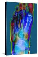 Normal Foot, X-ray-Du Cane Medical-Stretched Canvas