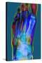 Normal Foot, X-ray-Du Cane Medical-Stretched Canvas