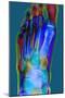 Normal Foot, X-ray-Du Cane Medical-Mounted Premium Photographic Print