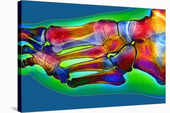 Normal Foot, X-ray-Du Cane Medical-Stretched Canvas