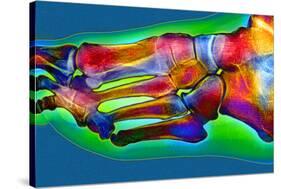 Normal Foot, X-ray-Du Cane Medical-Stretched Canvas