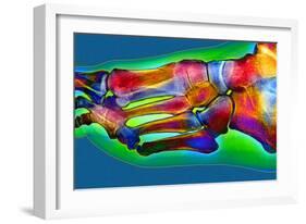 Normal Foot, X-ray-Du Cane Medical-Framed Photographic Print