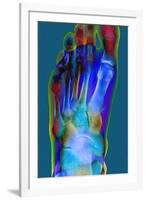 Normal Foot, X-ray-Du Cane Medical-Framed Photographic Print