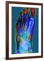 Normal Foot, X-ray-Du Cane Medical-Framed Photographic Print