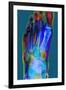 Normal Foot, X-ray-Du Cane Medical-Framed Photographic Print