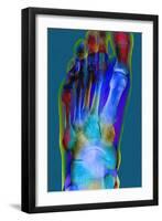 Normal Foot, X-ray-Du Cane Medical-Framed Photographic Print