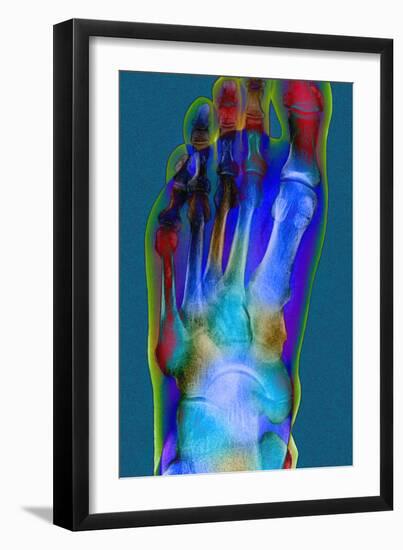 Normal Foot, X-ray-Du Cane Medical-Framed Photographic Print