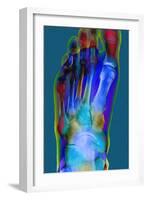 Normal Foot, X-ray-Du Cane Medical-Framed Photographic Print