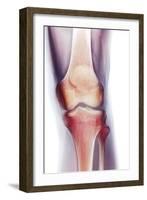 Normal Knee, X-ray-Du Cane Medical-Framed Photographic Print