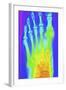 Normal Left Foot, X-ray-PASIEKA-Framed Premium Photographic Print