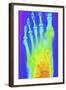 Normal Left Foot, X-ray-PASIEKA-Framed Premium Photographic Print