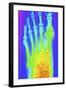 Normal Left Foot, X-ray-PASIEKA-Framed Premium Photographic Print