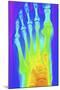 Normal Left Foot, X-ray-PASIEKA-Mounted Premium Photographic Print