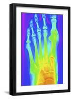 Normal Left Foot, X-ray-PASIEKA-Framed Photographic Print