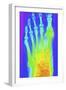 Normal Left Foot, X-ray-PASIEKA-Framed Photographic Print