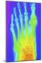 Normal Left Foot, X-ray-PASIEKA-Mounted Photographic Print