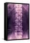 Normal Lumbar Spine, X-ray-Miriam Maslo-Framed Stretched Canvas