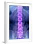 Normal Lumbar Spine, X-ray-Du Cane Medical-Framed Premium Photographic Print