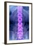 Normal Lumbar Spine, X-ray-Du Cane Medical-Framed Premium Photographic Print