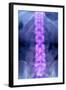 Normal Lumbar Spine, X-ray-Du Cane Medical-Framed Premium Photographic Print