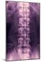 Normal Lumbar Spine, X-ray-Miriam Maslo-Mounted Photographic Print